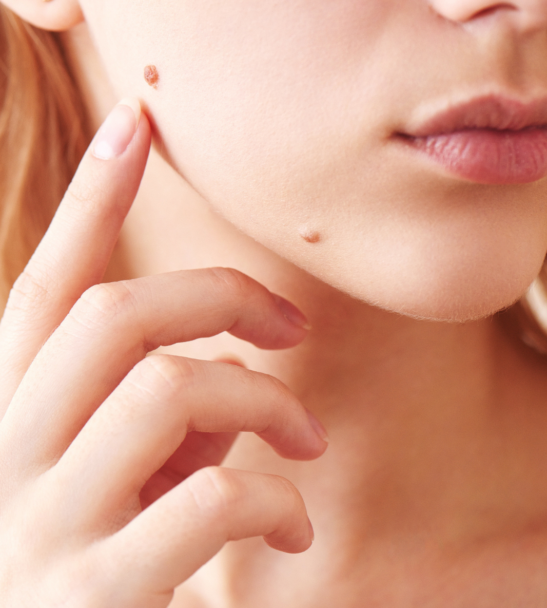 NeoGen Plasma Rejuvenation in Perth: The Award-Winning Treatment Redefining Skin Renewal at NBSkin