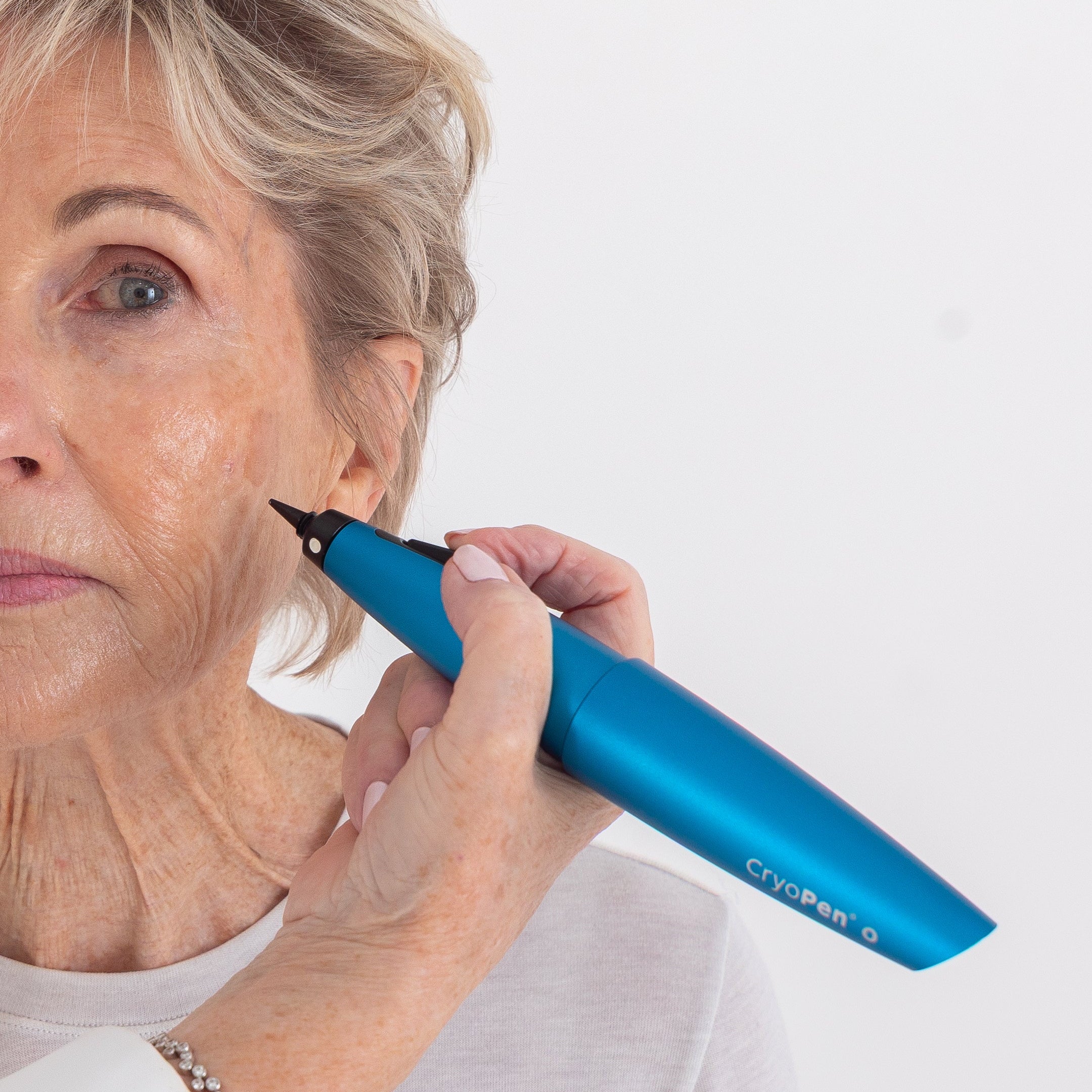 Why clients choose CryoPen