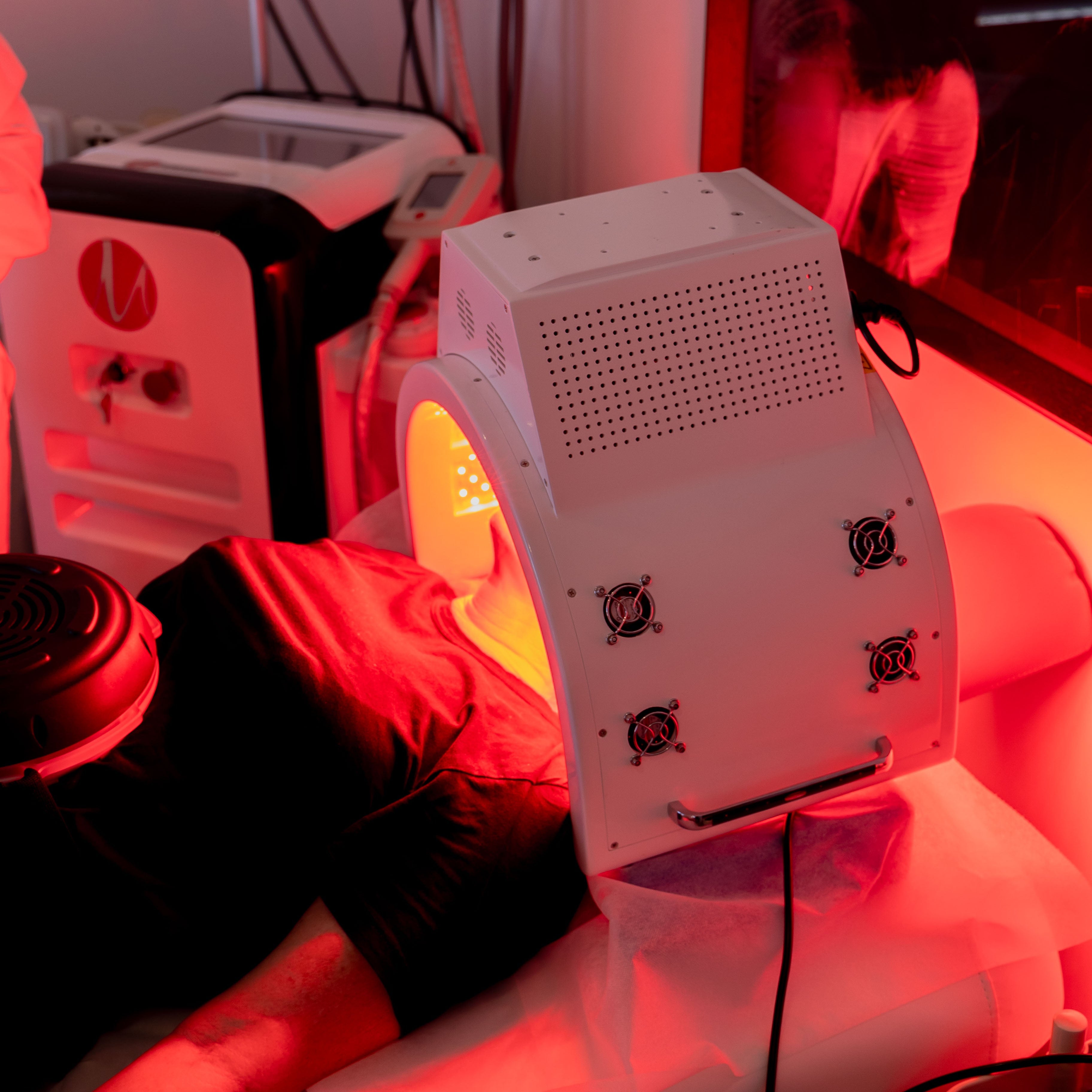 Photo Facial (Red Light Therapy)