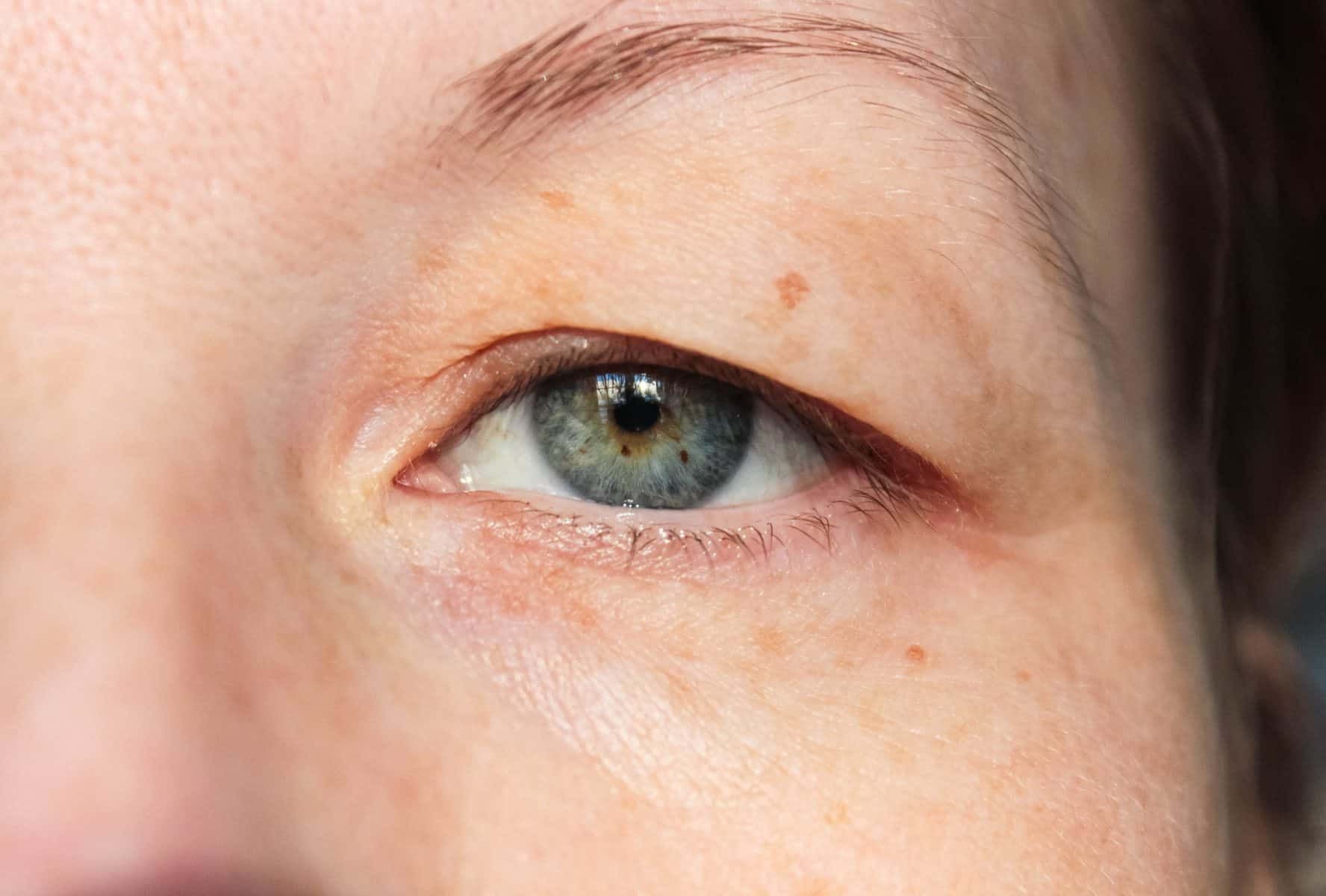 Why eyelids change over time
