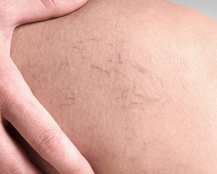 Precision technology that works where others can't