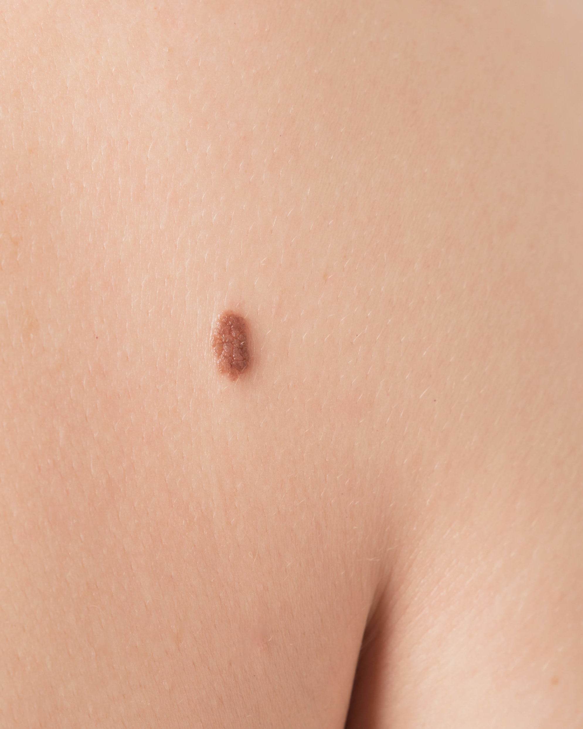 What your skin is telling you