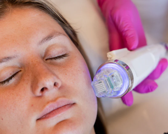 Skin Needling
