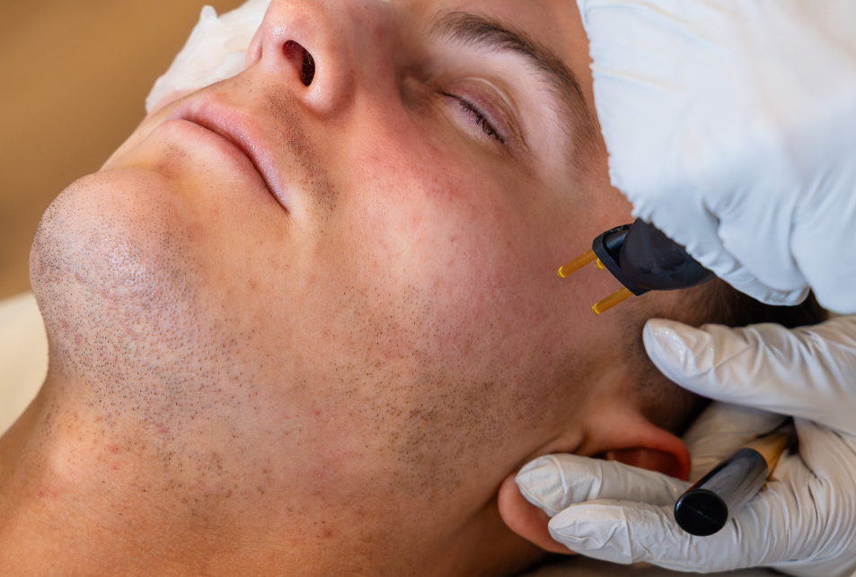 What are the benefits?